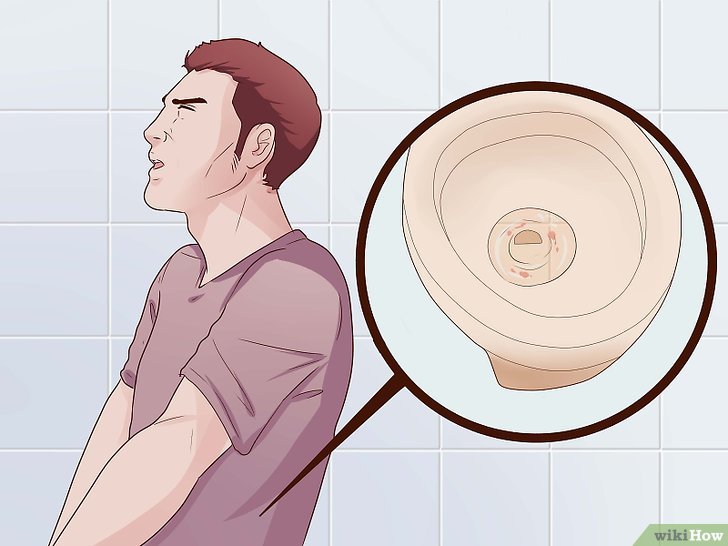 Obat Sipilis Di Farmasi Malaysia